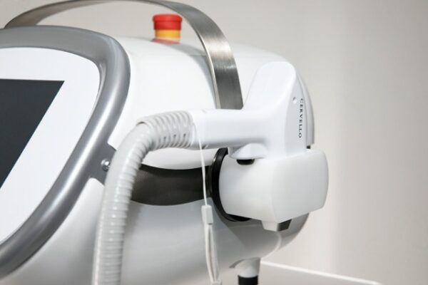 Laser Hair Removal Consultation